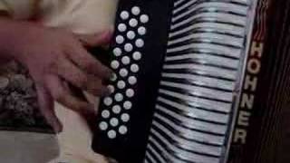 Intocable - Hoy Duele