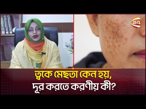 ত্বকে মেছতা কেন হয়, দূর করতে করণীয় কী? | Skin roughness | Channel 24