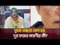 ত্বকে মেছতা কেন হয় দূর করতে করণীয় কী