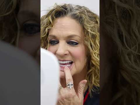TINA - Full  Mouth Dental Implants