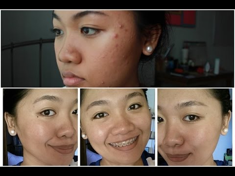 SKINMATE SHARK OIL DO'S AND DON'TS (Tagalog) | Grace Villanueva