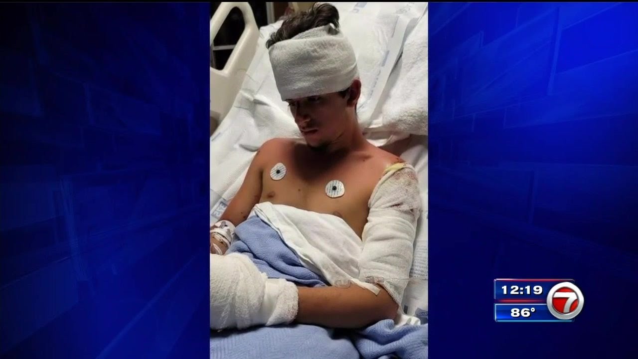 Teen cyclist hospitalized after officer-involved crash in SW Miami-Dade