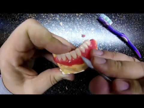 Моделирование базиса. Моделировка базиса частичного съемного протеза. Окончательная моделировка базиса. Окончательная моделировка съемного протеза. Окончательное моделирование протеза.