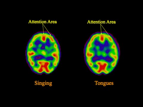 Neuroscience of Glossolalia