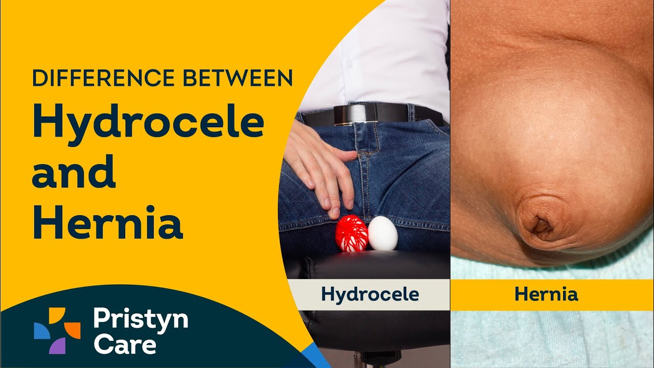 Difference between Hydrocele and Hernia