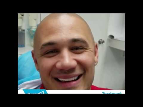 Los Algodones Mexico Dental Solutions. Actual Patient Review