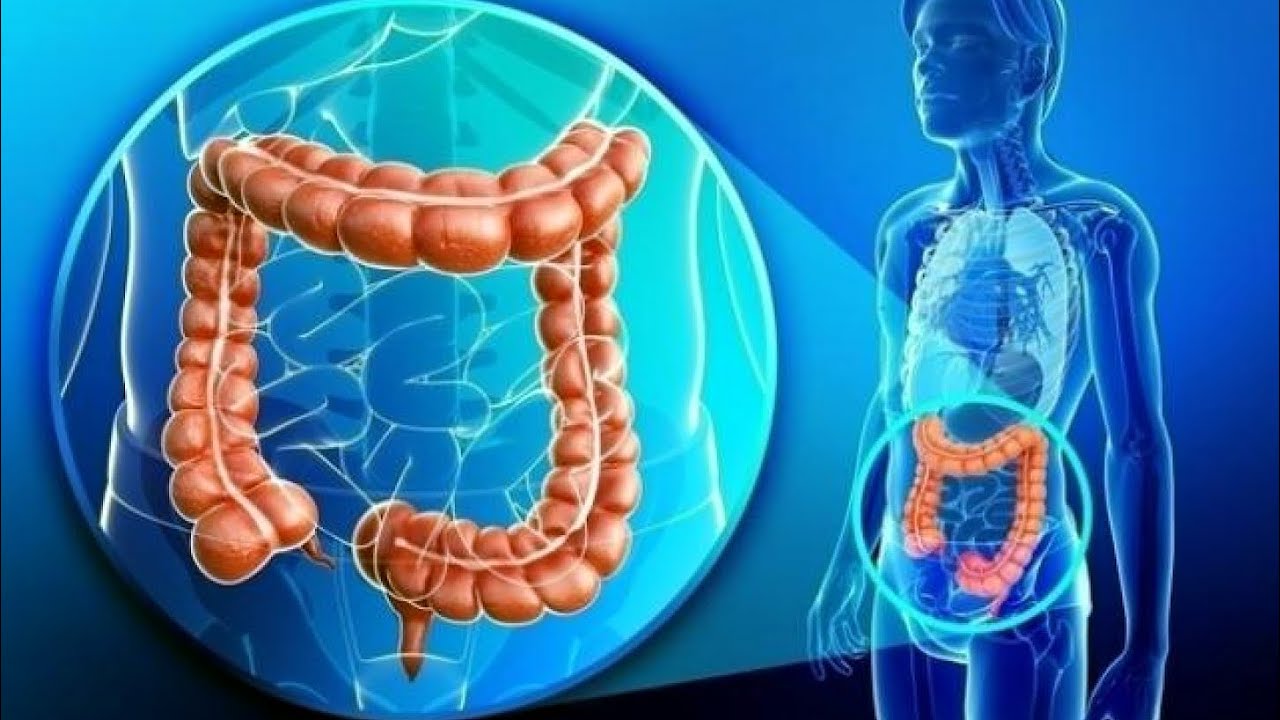 Franco Berrino: La dieta antinfiammatoria per le Malattie Infiammatorie Croniche Intestinali (MICI)