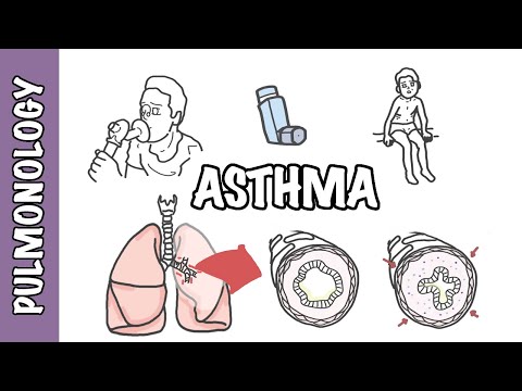 Comprendre l'Asthme - Physiopathologie et Traitement 