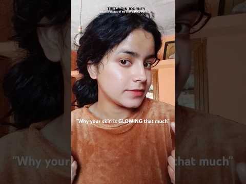 2yr of using tretinoin (retinol) - skin transformation is insane #tretinoin #retinol #acnemarks#acne