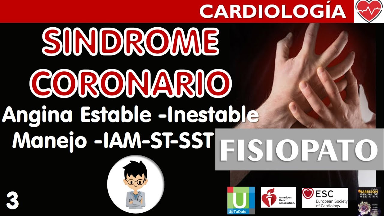 ANGINA ESTABLE INESTABLE, MANEJO del IAM con y sin ELEVACIÓN ST Complicaciones, Síndrome Coronario|3