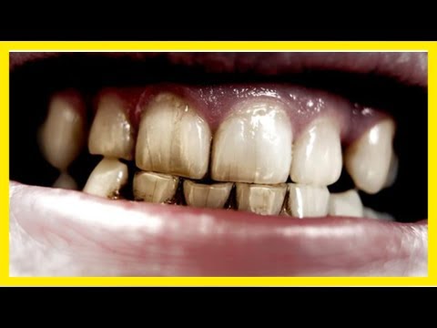 16 atriði sem skemma brosið þitt - dv