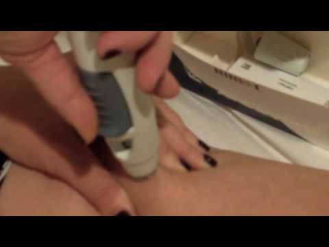 Simponi Golimumab Injection