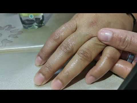 Mijat  Jari2  bengkak/pegel