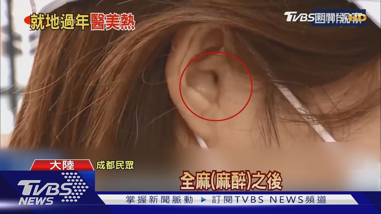 隆鼻麻醉醒來耳屏沒了 陸女:怎戴耳機