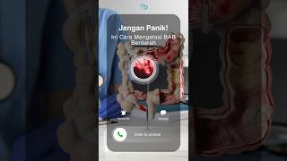Download lagu Jangan Panik! Ini Cara Mengatasi BAB Berdarah#shorts #tips #atasi #babberdarah mp3