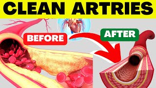 Top 15 Amazing Foods That Cleanse Your Arteries and Prevents Heart Attacks