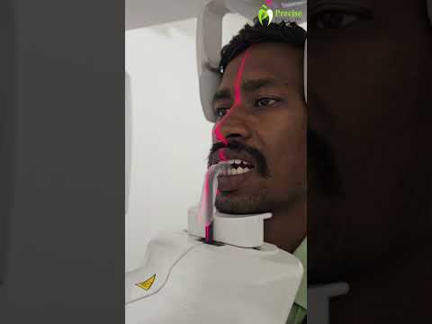 How is an OPG X-ray done at Precise Dental Care?