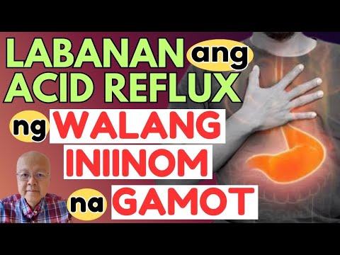 Labanan ang Acid Reflux ng Walang Iniinom na Gamot. - By Doc Willie Ong
