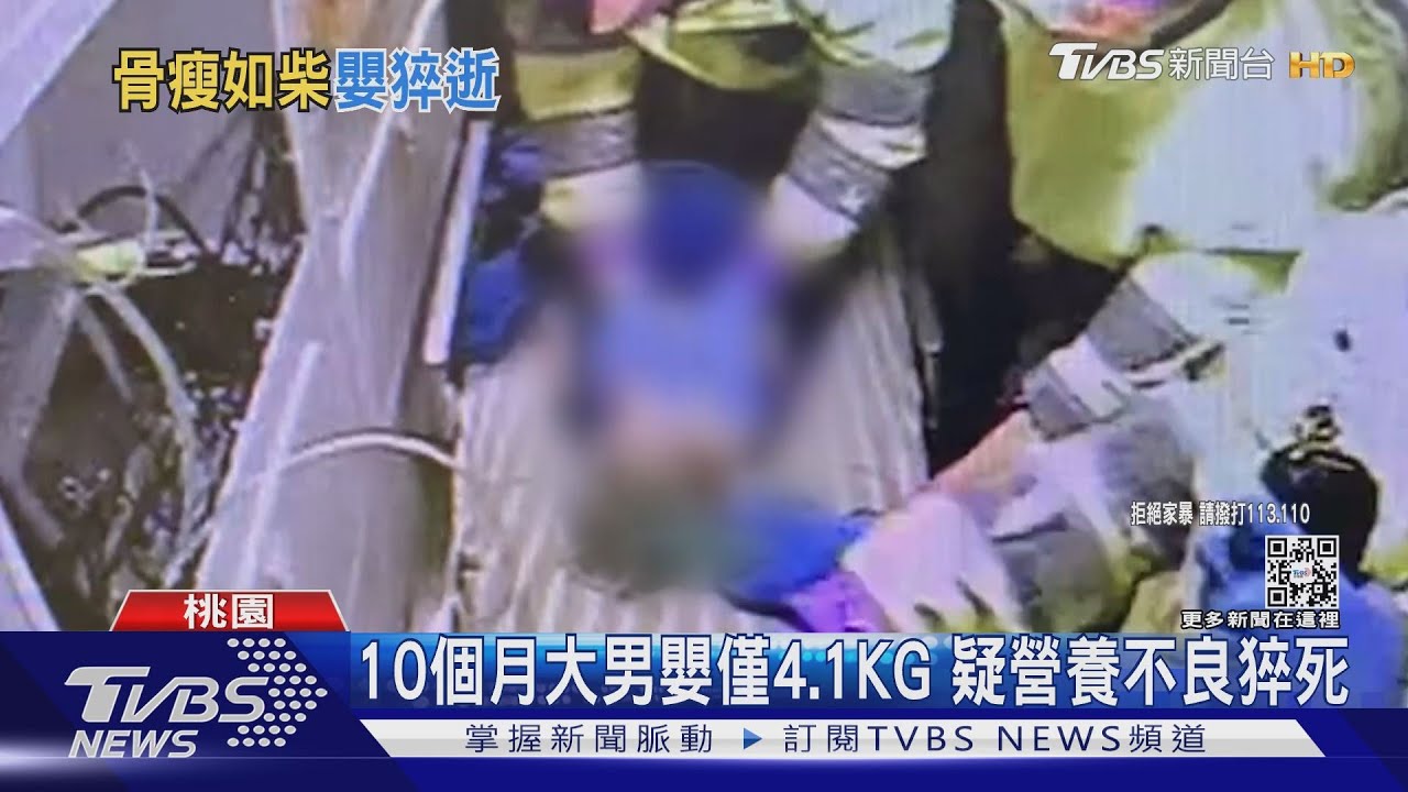 10個月大男嬰僅4.1KG 疑營養不良猝死