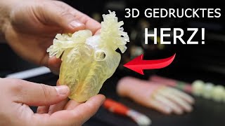 3D-Druck kann LEBEN retten! | Stratasys