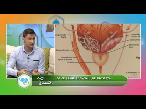Recenzii despre prostatita vindecată 🏠 Urotrin cumpărați în Moldova-Noue