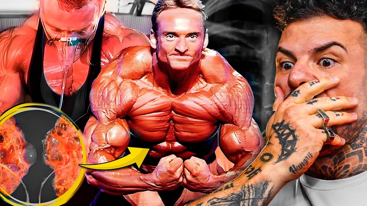 Esse Bodybuilder Já Estava Morto e Não Sabia...