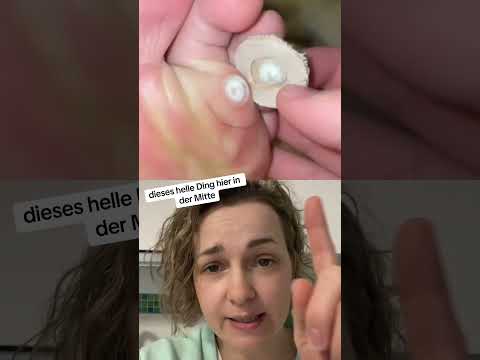 Warzenpflaster ￼ #podoshorts