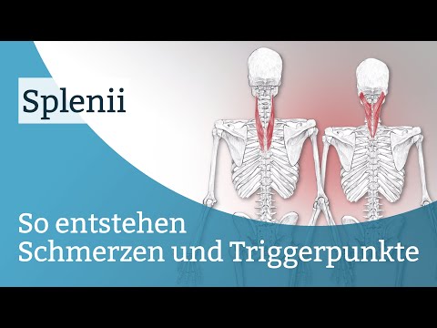 Schmerzen im Nacken zwischen der Schulter Wie hip Coxarthrose zu Hause Bewertungen behandeln