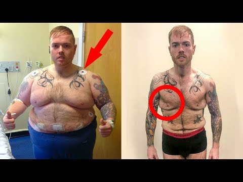 This Guy Was Too Fat And Shy To Go Outside. What He Did Later Was Insane! Video