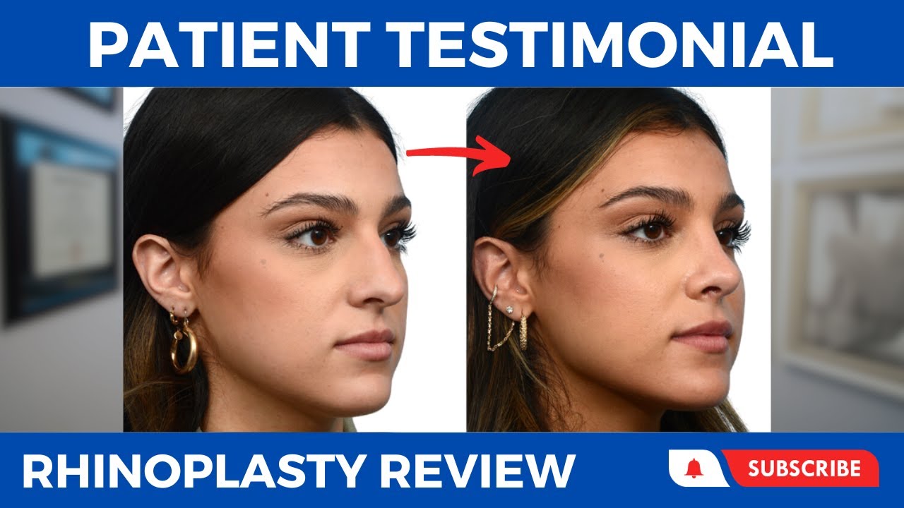 Rhinoplasty in New Jersey Nose Surgery NJ Wise Center for Plastic Surgery
