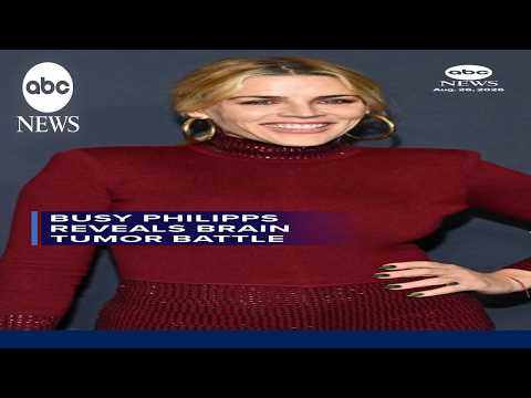 Busy Philipps reveals brain tumor battle