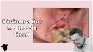 4 Dicas Para Diminuir a Dor no Dente do Siso em Casa - Pericoronarite: Como Tratar