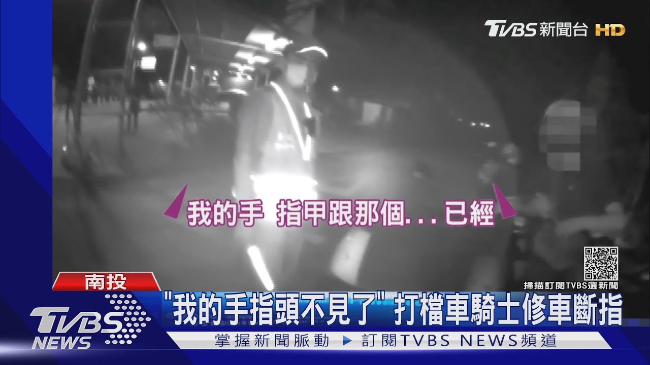 「我的手指頭不見了」　打檔車騎士修車斷指