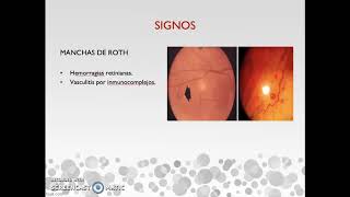 Seminario Endocarditis. Dra. Mariana Martino.