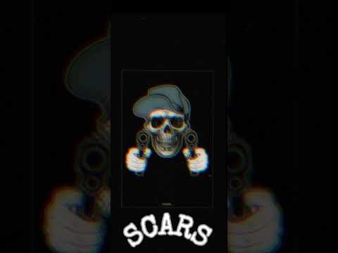 Shawno - Scars [Official Audio]