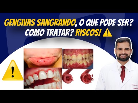 Francisco De Assis Almeida Lima Júnior-107
