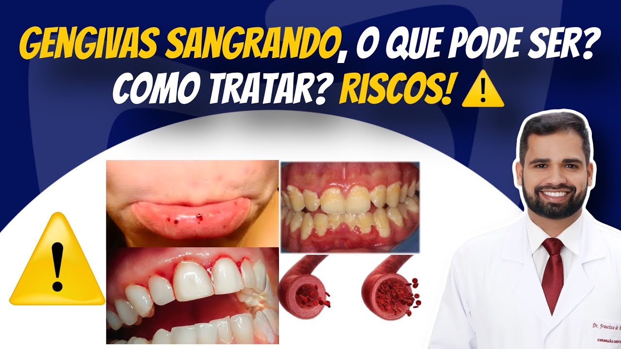 Francisco De Assis Almeida Lima Júnior-107