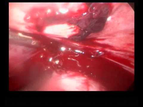 Rajani Hospital Video 2