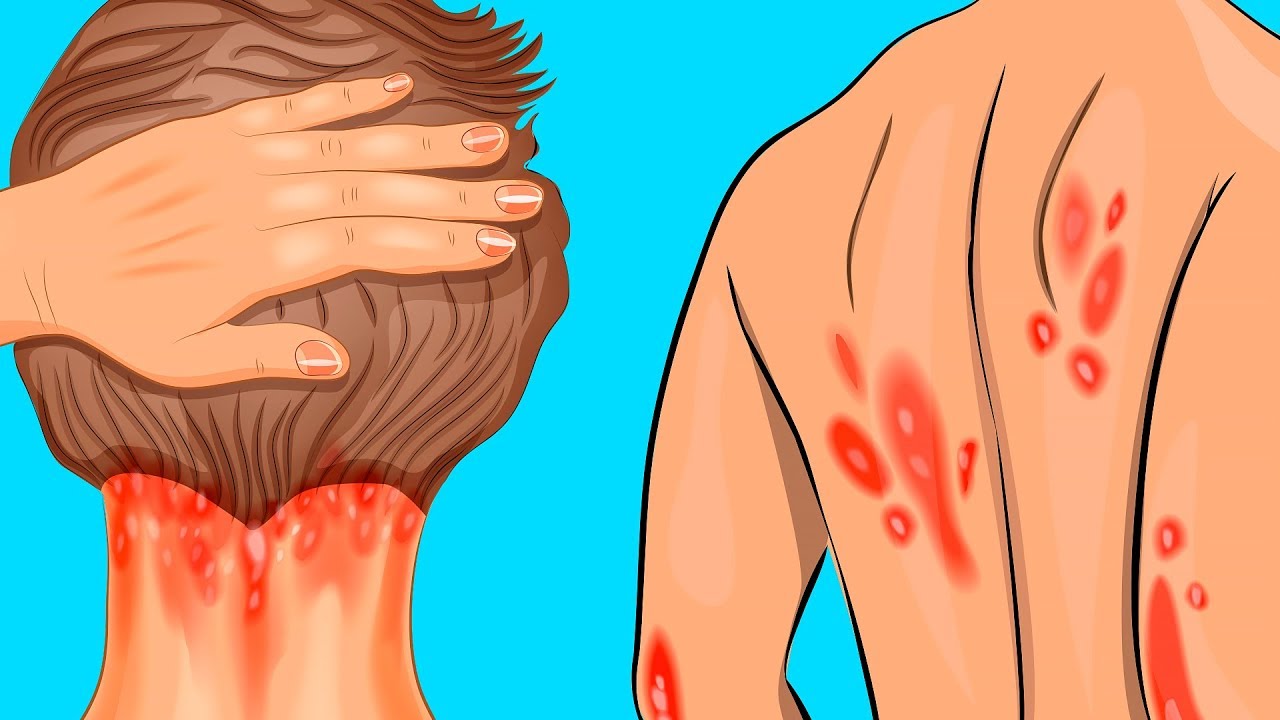 10 Sinais Alarmantes De Que Você Pode Ter Deficiência de Vitamina D