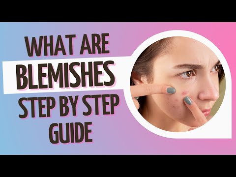 What are Blemishes? Step by Step Guide