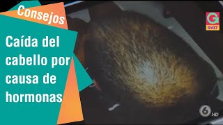 Caída de cabello por causa de hormonas | Consejos para usted
