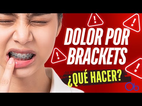 DOLOR POR BRACKETS 😬 ¿QUÉ HACER?