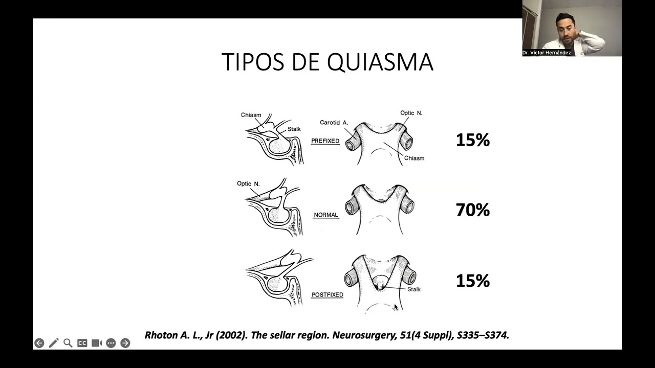 Victor Hernandez Alvarez-12