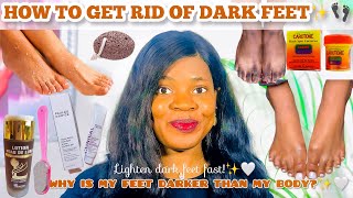 HOW TO GET RID OF DARK FEET | DISCOLORATION + *Lighten Dark Body Parts* Dark feet *Black toe* |Ankle