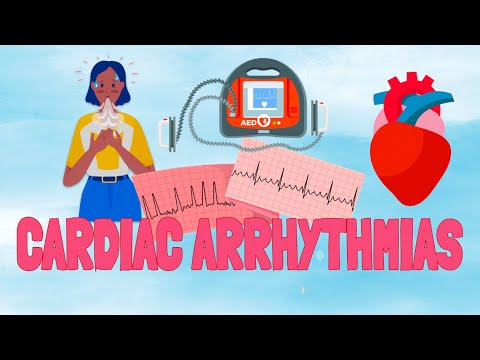 Cardiac Dysrhythmias & Treatment (Exam Review)