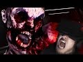 OUTLAST ALL OVER AGAIN | Affected: The Asylum ...