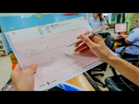 Interactive CPD Series | Episode 16 | ECG Basics (Part 2)