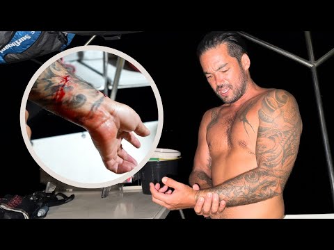 VON EINEM HUND IN PAPUA-NEUGUINEA ANGEGRIFFEN! 👀 – (Folge 298)