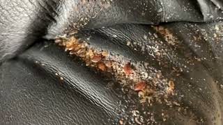 THOUSANDS of BED BUGS infesting a leather couch.