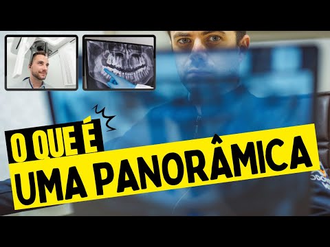 O QUE É UMA RADIOGRAFIA PANORÂMICA | ASB TOTAL